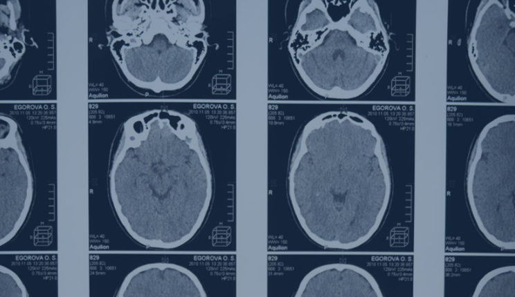 Genova capitale europea della ricerca sul cervello grazie a Mnesys: triplicati i centri coinvolti